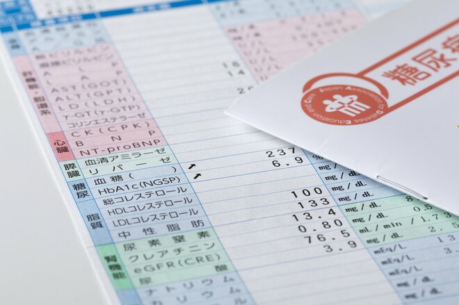 血糖値、心不全…精神科医・和田秀樹氏がじわりと「老化」を感じたサインとは
